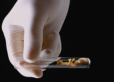 试管婴儿可不可以决定胎儿性别？