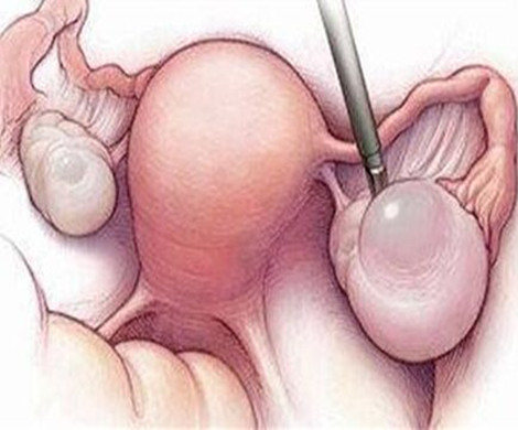 如果取出未成熟卵子能配成囊胚吗？