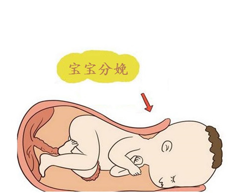泰国试管婴儿一定要选择剖腹产吗？